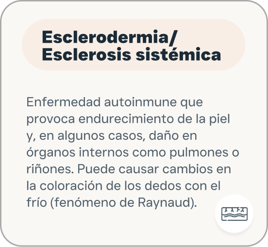 Esclerodermia.