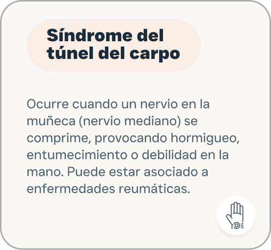 Síndrome del túnel carpo.