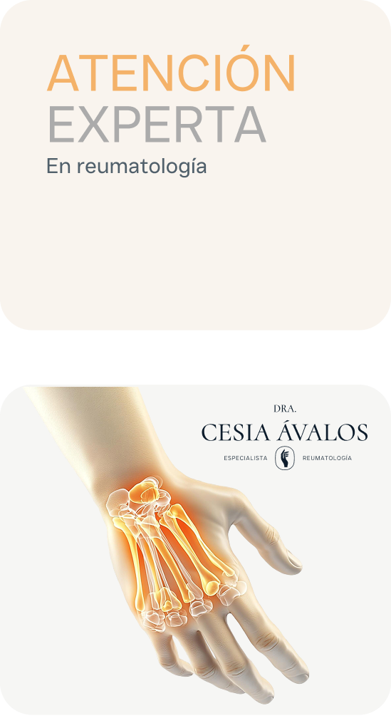 Ícono Reuma Cesia